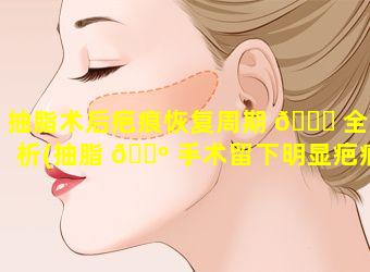 抽脂术后疤痕恢复周期 🐕 全解析(抽脂 🌺 手术留下明显疤痕凸起)